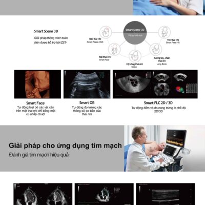 Một số tính năng cao cấp hiện có trên máy siêu âm 5D Mindray Consona N7.