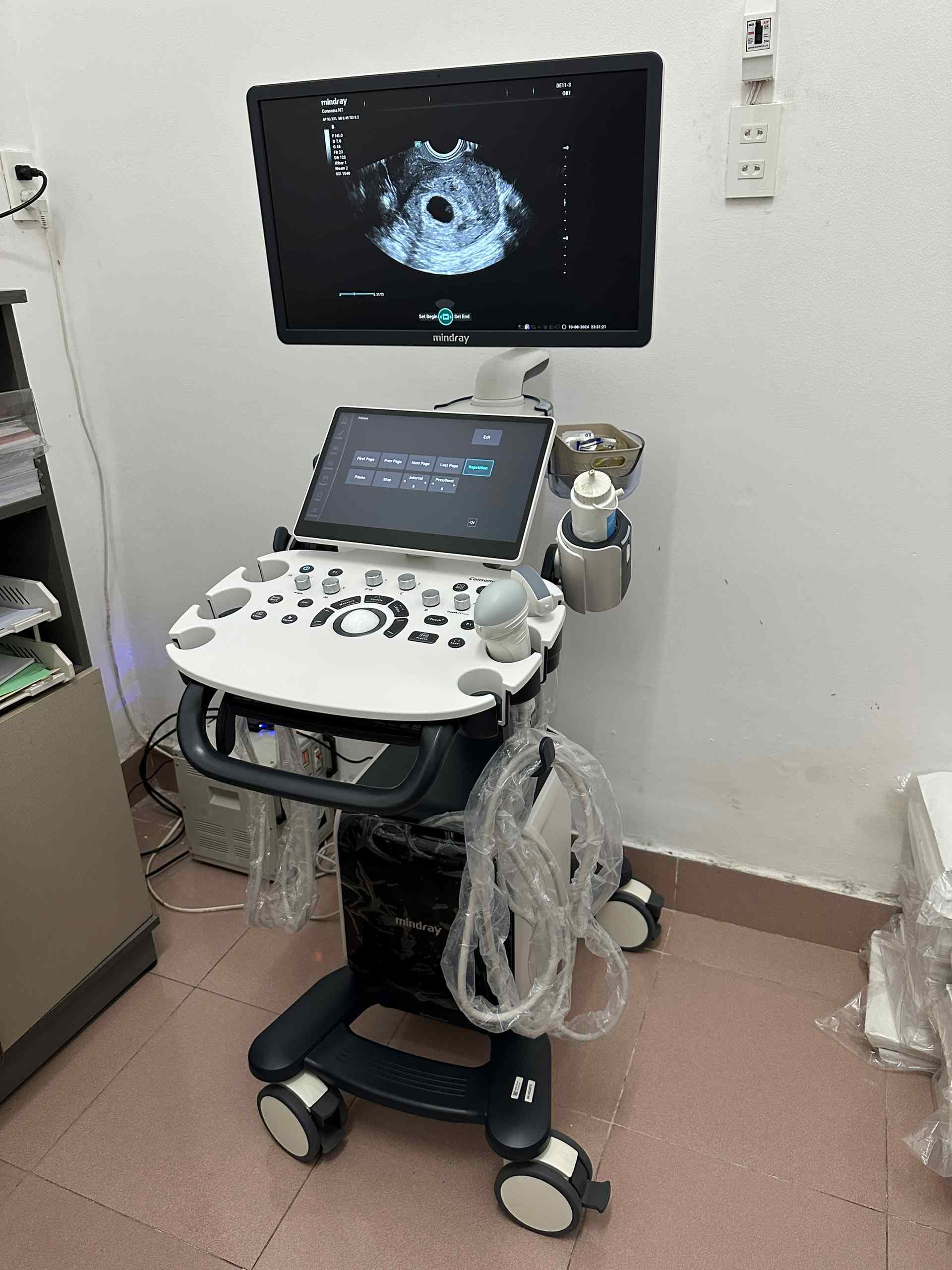 Lắp đặt máy siêu âm 5D Mindray Consona tại Xuân Lộc, Đồng Nai cho phòng khám chuyên sản phụ khoa.