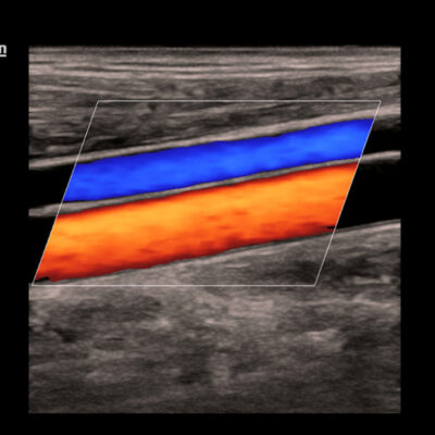 Máy siêu âm 4D/5D Mindray DC30 FullHD