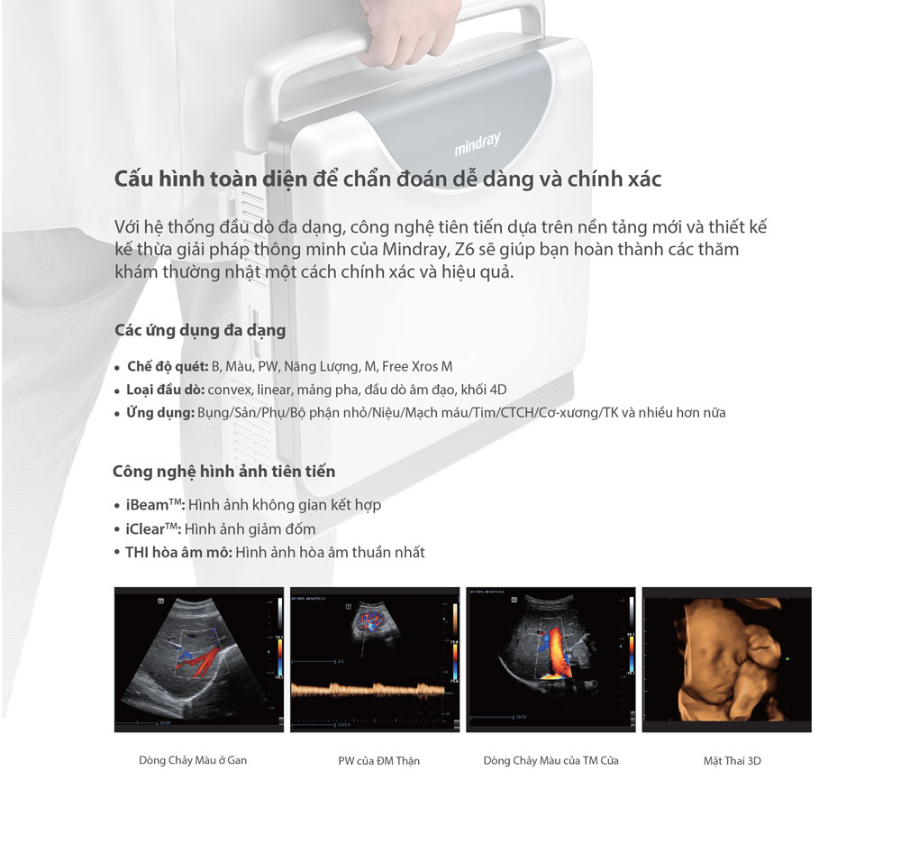 Máy siêu âm xách tay Mindray Z6 2D Doppler màu chuyên tim Máy siêu âm xách tay Mindray Z6 2D Doppler màu chuyên tim