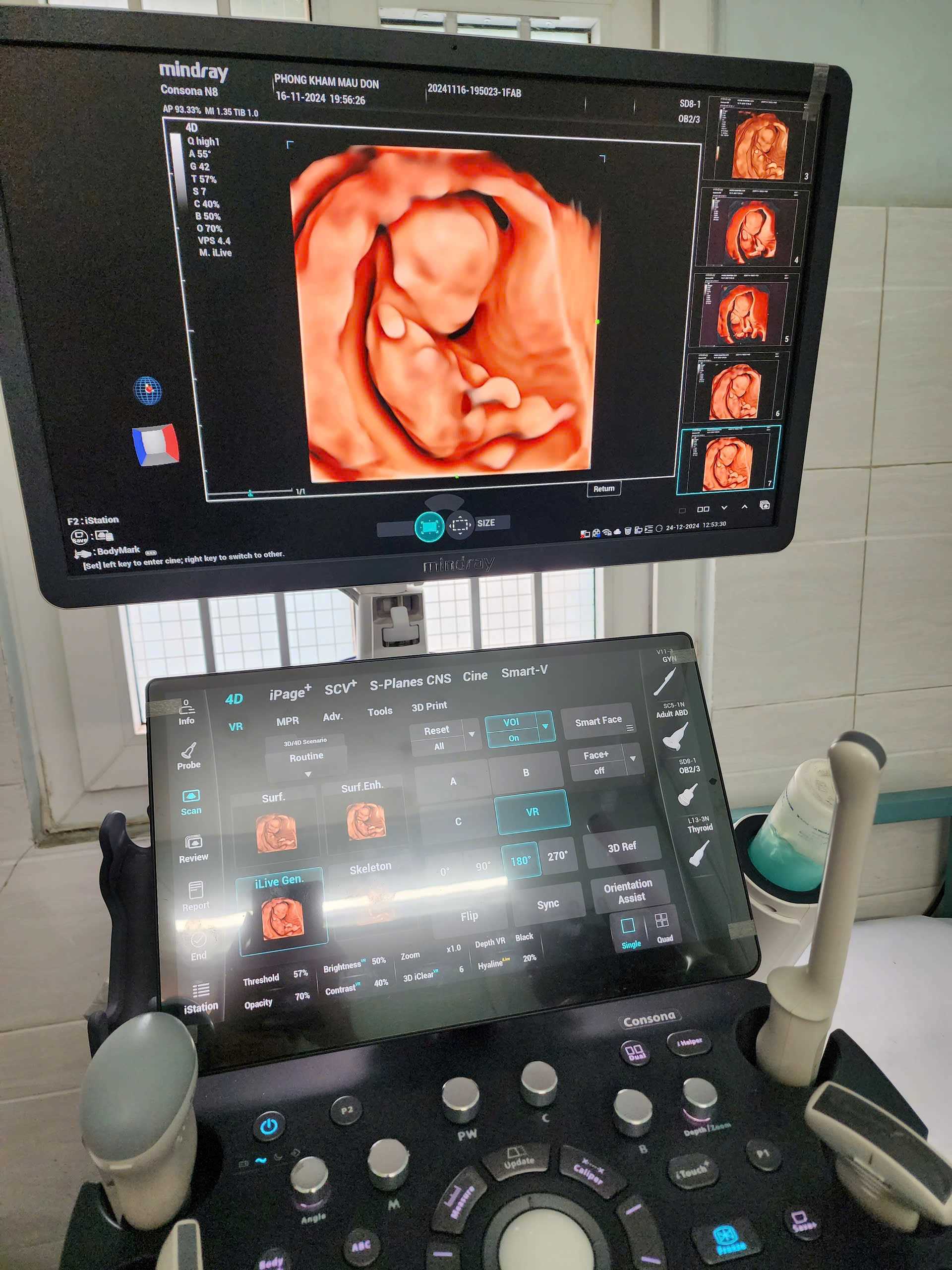 Máy siêu âm cao cấp Mindray Consona N8 thiết kế chuyên nghiệp, tích hợp đa dạng tính năng.