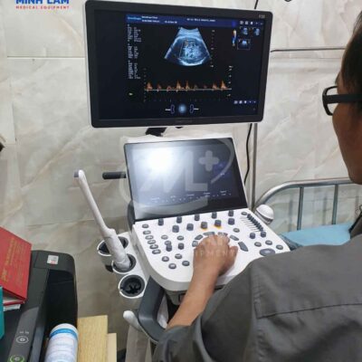Máy siêu âm 5D Sonoscape P20 - Tiêu chuẩn FDA Mỹ