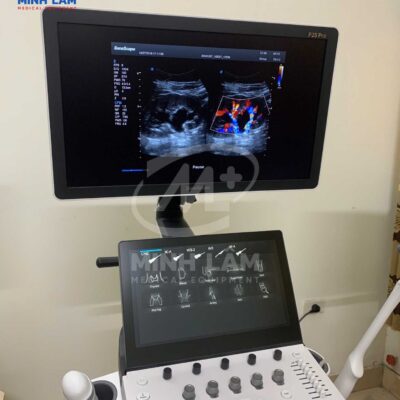 Siêu âm mạch máu khảo sát thận trái phải bằng doppler màu trên Sonoscape P25Pro.