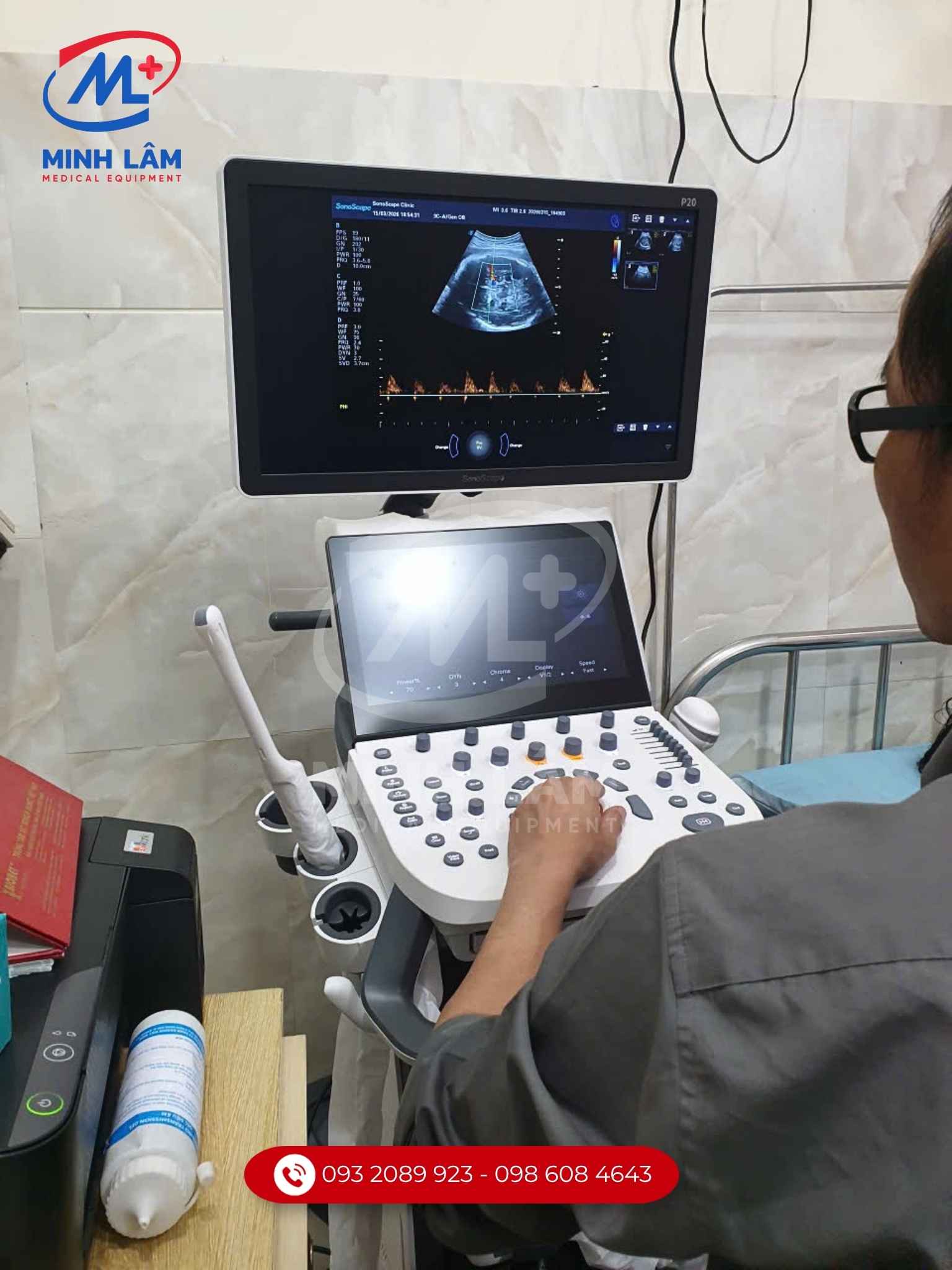 Máy siêu âm 5D SonoScape P20 thiết bị chẩn đoán hình ảnh sắc nét, tiêu chuẩn FDA Mỹ.