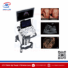 Máy siêu âm 5D Sonoscape P20 - Tiêu chuẩn FDA Mỹ