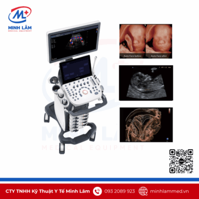 Máy siêu âm 5D Sonoscape P20 - Tiêu chuẩn FDA Mỹ