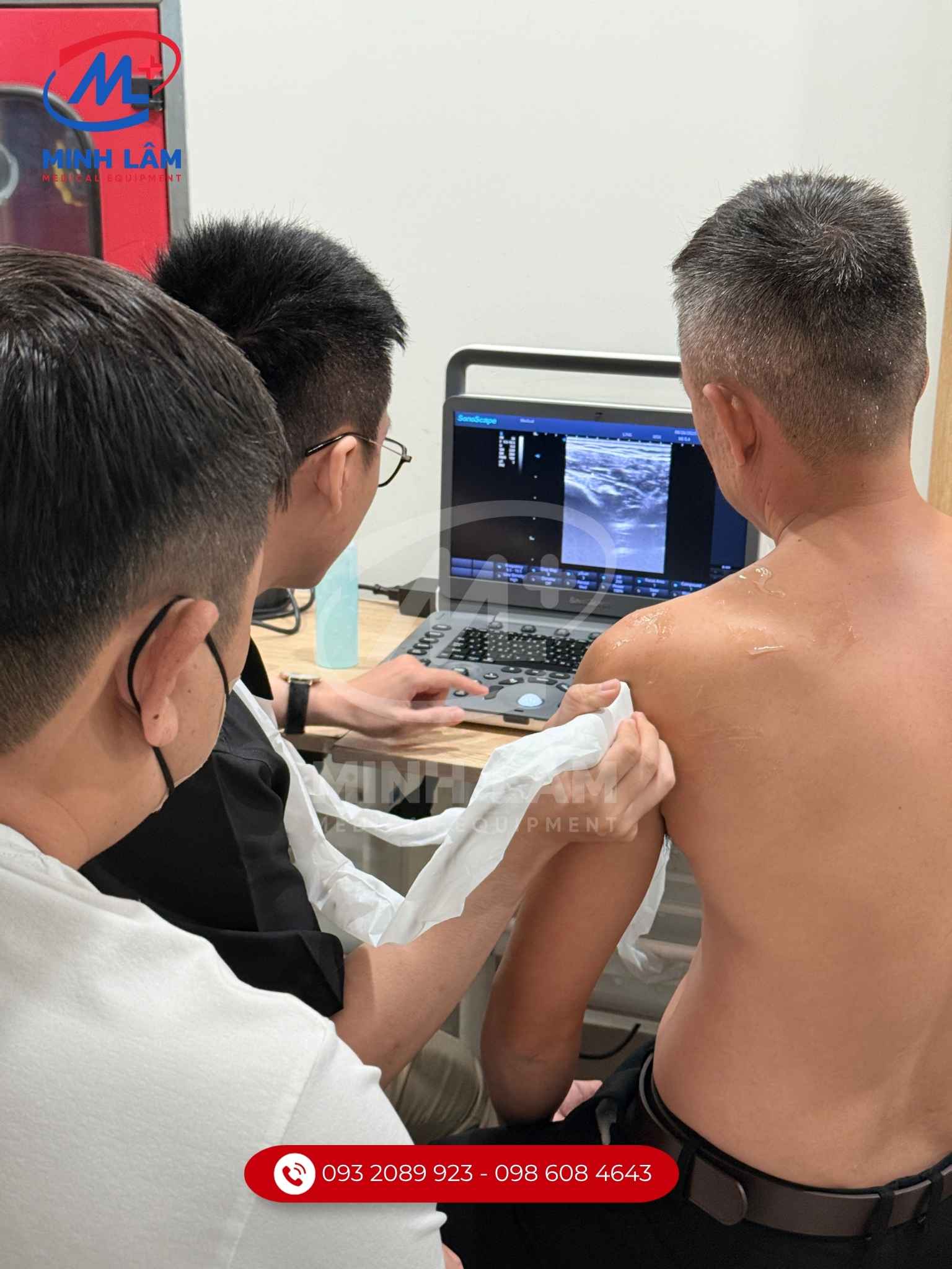Máy siêu âm xách tay màu SonoScape E2 ứng dụng siêu âm cơ xương khớp sắc nét.