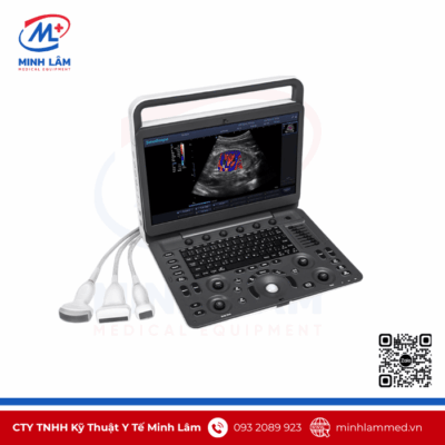 Máy siêu âm xách tay Doppler màu Sonoscape E2