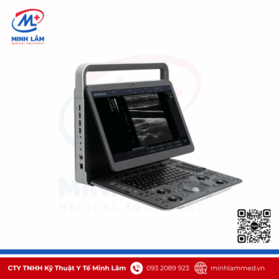 Máy siêu âm xách tay Sonoscape E1 chính hãng