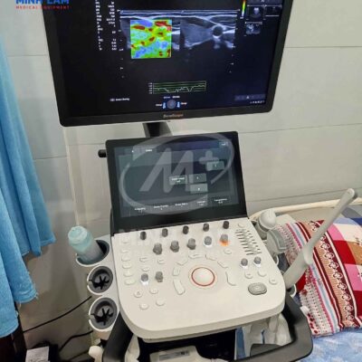 Máy siêu âm 5D Sonoscape P25 Pro - Ứng dụng trí tuệ Ai