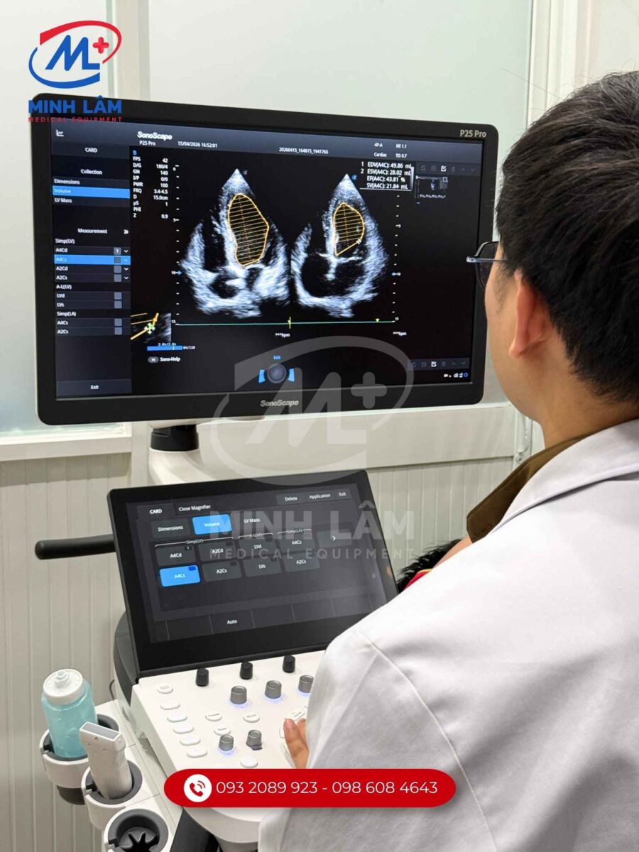 Máy siêu âm 5D Sonoscape S55 ứng dụng AI - FDA Mỹ