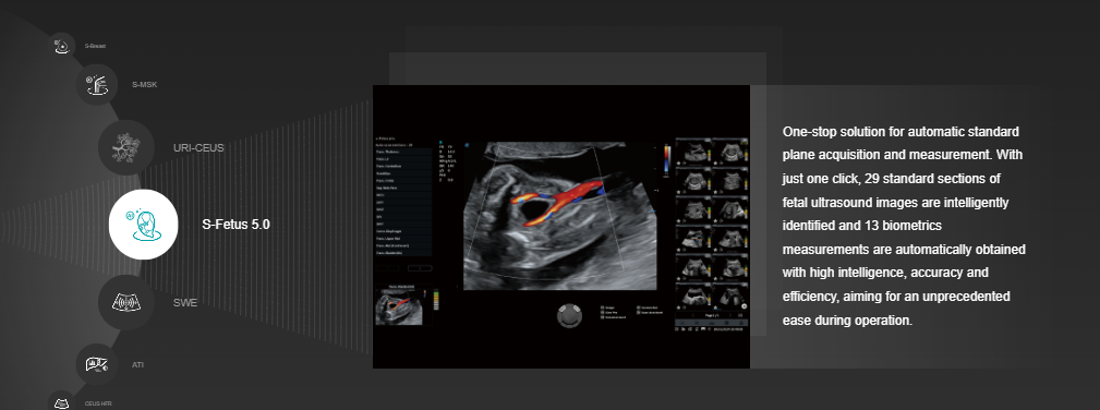 S-Fetus - Ứng dụng trí tuệ AI hiện đại nhận diện và đo các chỉ số thai nhi.
