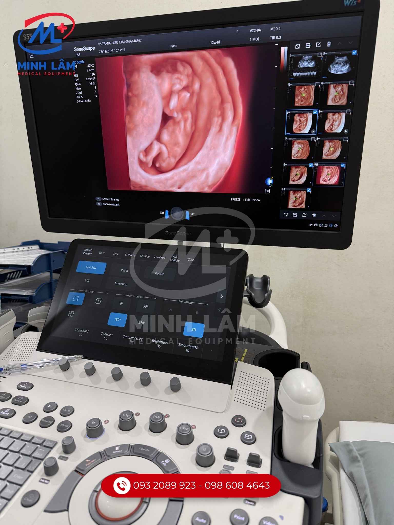 Công nghệ siêu âm 5D SLive tái tạo màu da chân thực, đa nguồn sáng làm nổi bật hình ảnh.
