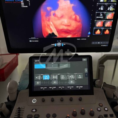 Máy siêu âm 5D Sonoscape S55 ứng dụng AI - FDA Mỹ
