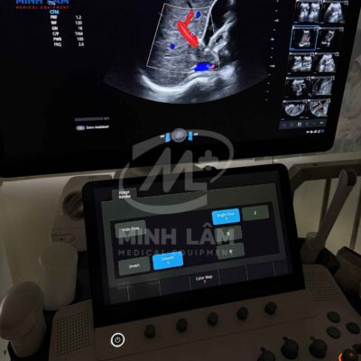 Siêu âm tổng quát bụng hình ảnh 2D sắc nét, dòng màu doppler đẹp.