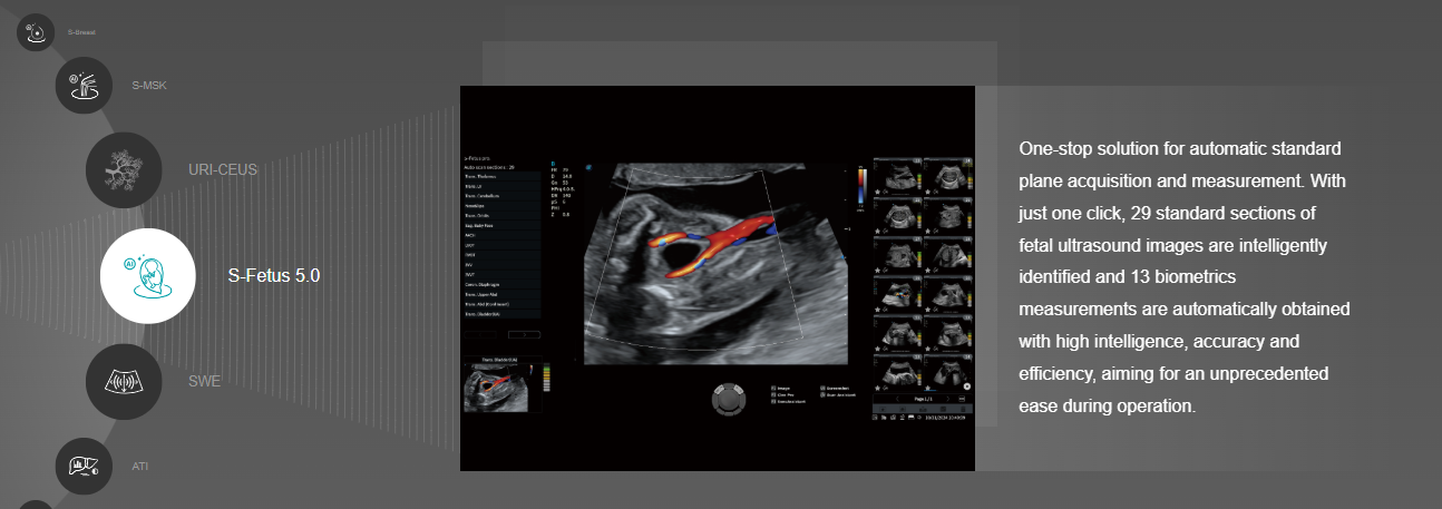 Ứng dụng trí tuệ AI trong siêu âm chẩn đoán sản khoa S-Fetus trên máy siêu âm Sonoscape S55.