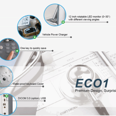 Máy siêu âm xách tay Chison Eco1 - Chính hãng, giá rẻ