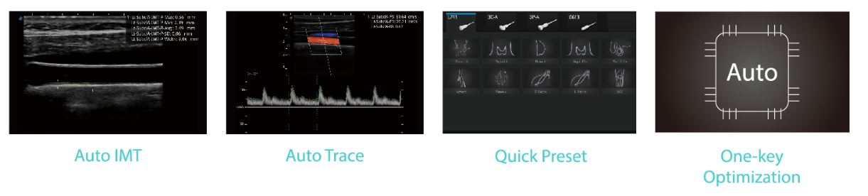 Các tính năng thông minh auto imt, auto trace, auto tối ưu hóa hình ảnh trên Sonoscape E3.