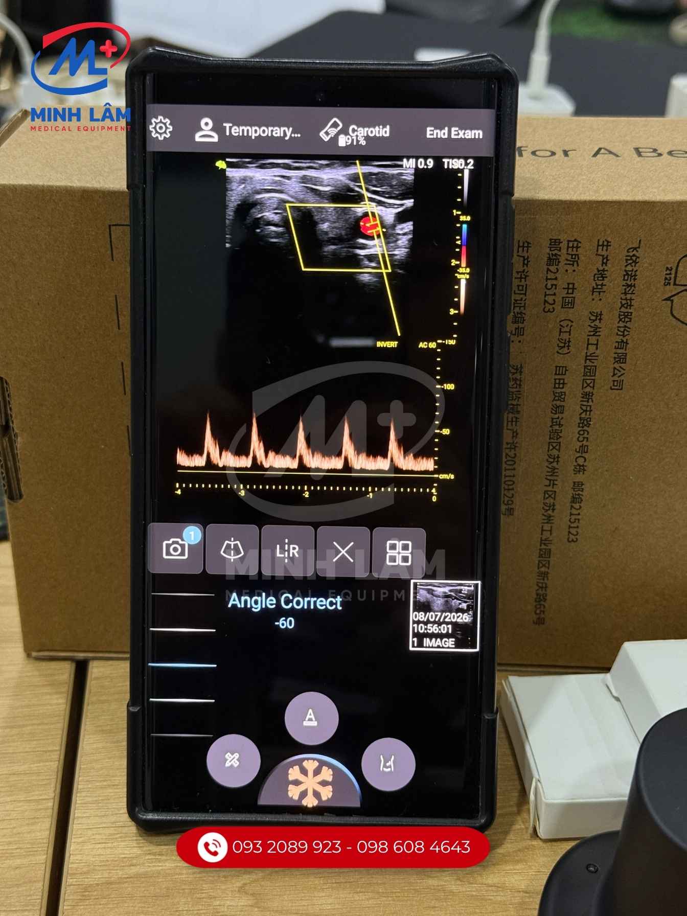 Siêu âm mạch máu doppler màu, doppler xung PW.