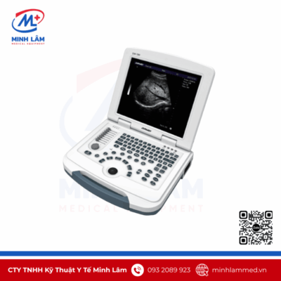 Máy siêu âm xách tay giá rẻ DW580 - Thương hiệu: Dawei