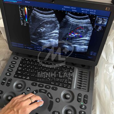 Máy siêu âm Sonoscape E3 - Cấu hình chuyên tim, 3 cổng cắm đầu dò