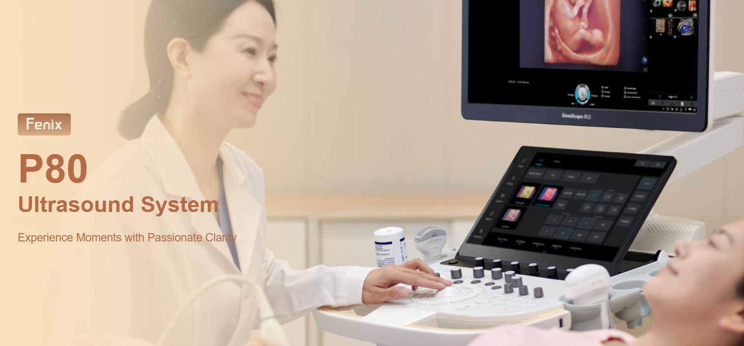 Máy siêu âm 5D Sonoscape P80 hiện đại, chuyên gia hỗ trợ chẩn đoán hình ảnh, công nghệ nền tảng WIS+ AI.
