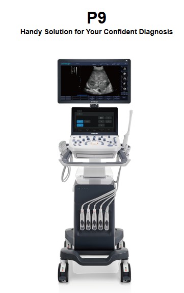 Hệ thống siêu âm bàn đẩy Sonoscape P9 2d doppler màu, 4 cổng cắm đầu dò.