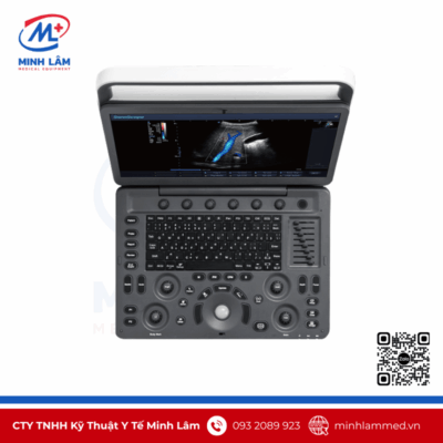 Máy siêu âm Sonoscape E3 - Cấu hình chuyên tim, 3 cổng cắm đầu dò Máy siêu âm Sonoscape E3 - Cấu hình chuyên tim, 3 cổng cắm đầu dò