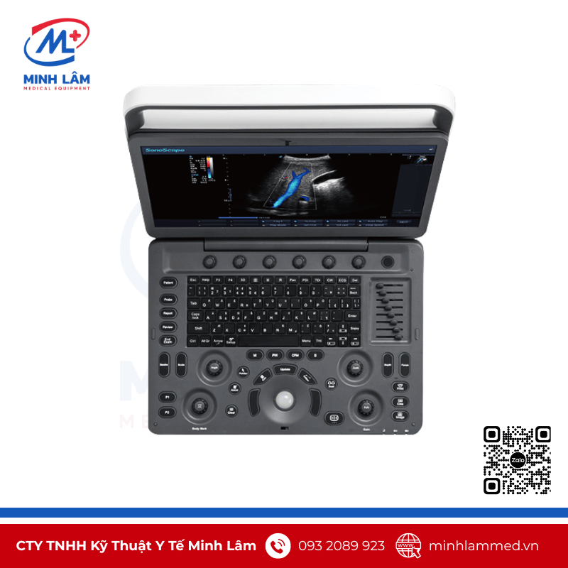 Máy siêu âm Sonoscape E3 - Cấu hình chuyên tim, 3 cổng cắm đầu dò Máy siêu âm Sonoscape E3 - Cấu hình chuyên tim, 3 cổng cắm đầu dò