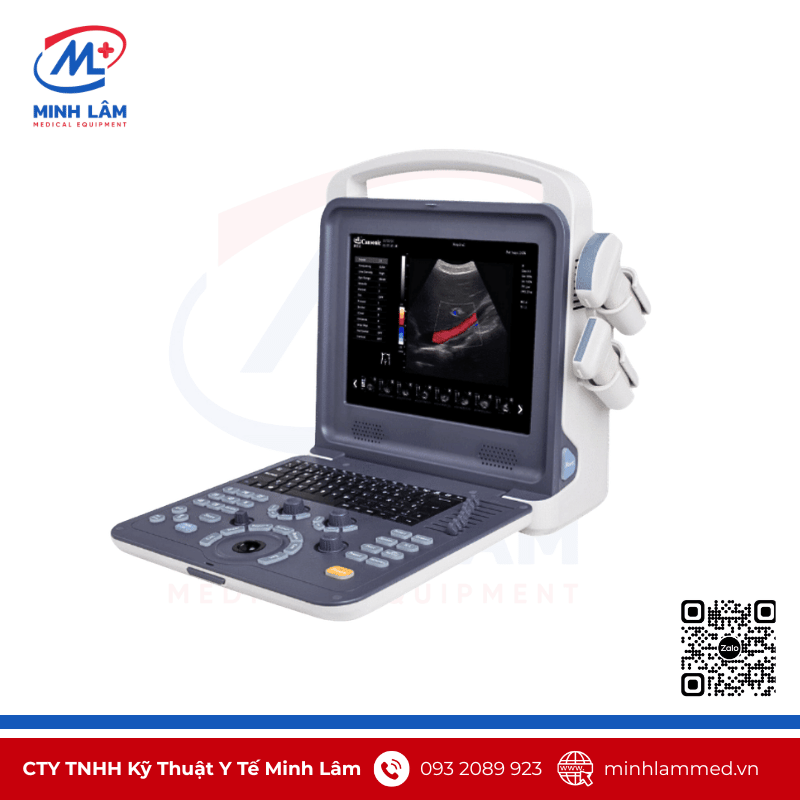 Máy siêu âm xách tay 2D Cansonic K0 giá rẻ Máy siêu âm xách tay 2D Cansonic K0 giá rẻ