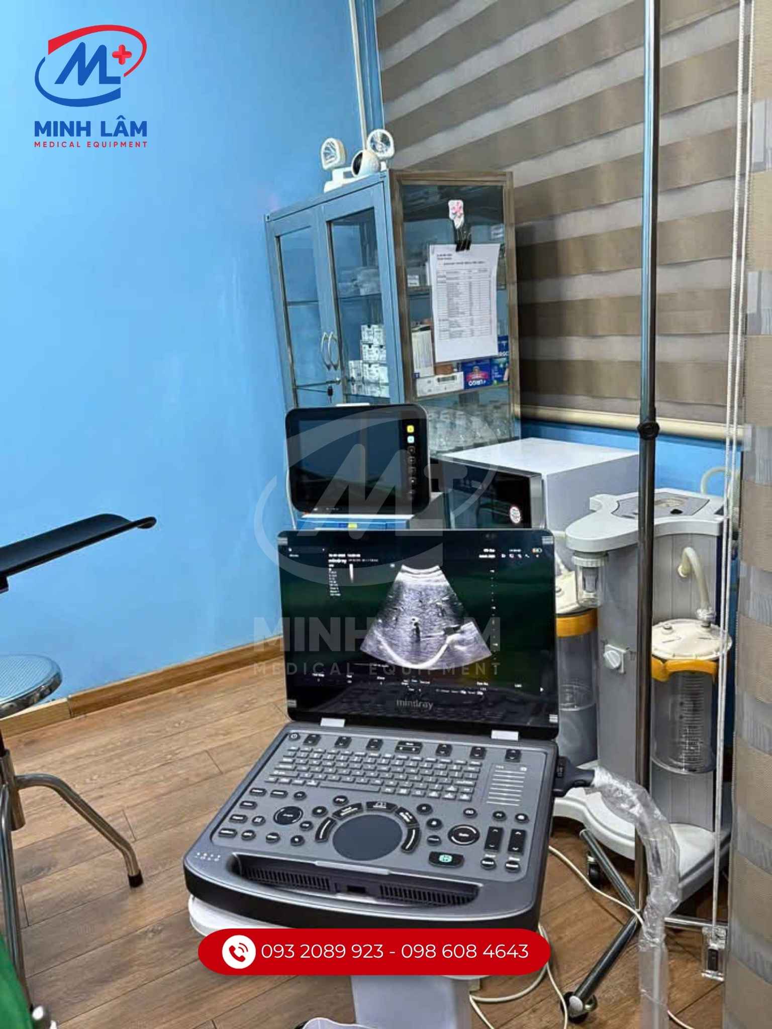 Hệ thống mindray mx3 trang bị phòng phẫu.