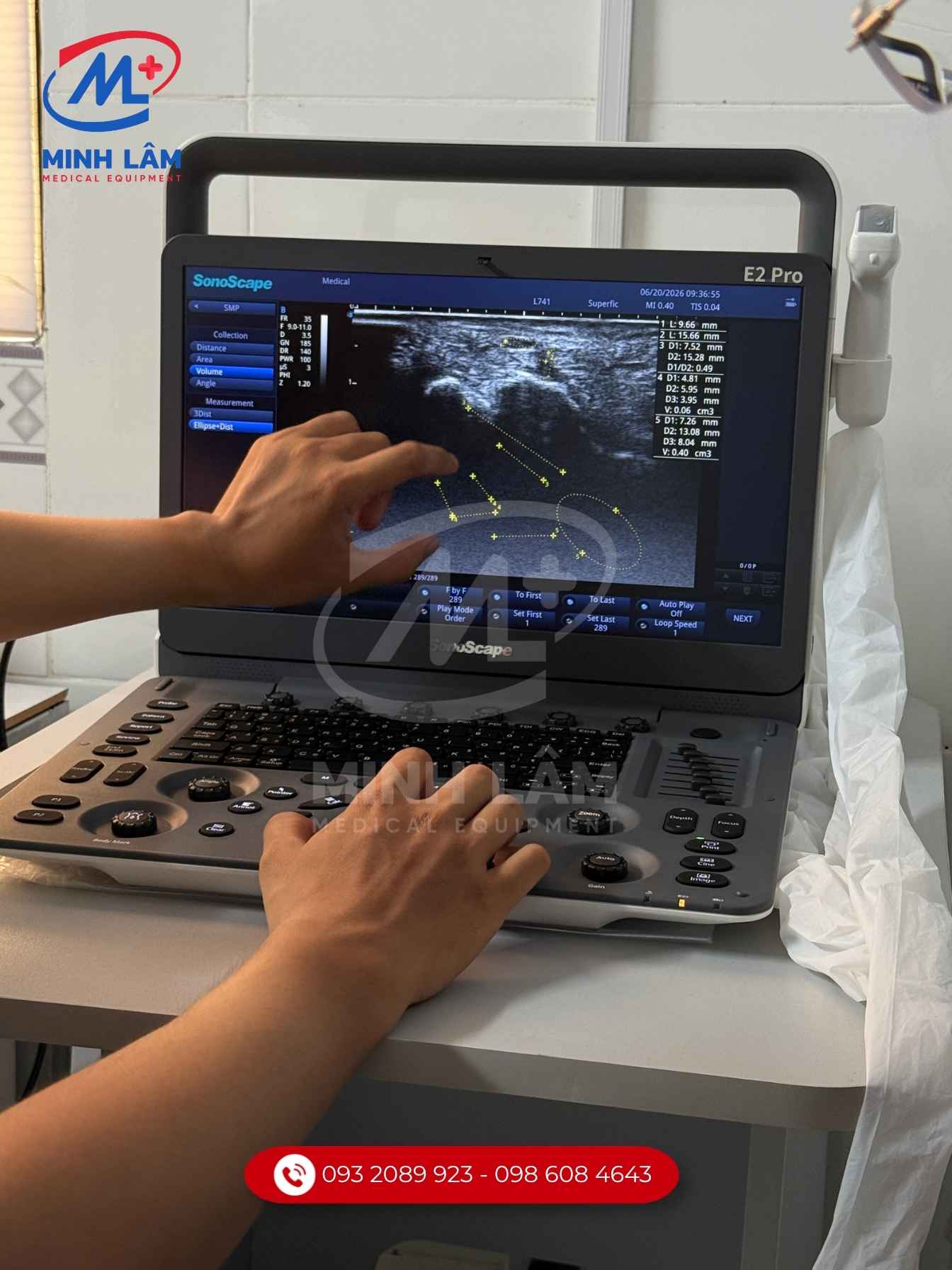 bàn giao máy cho phòng khám khởi nghiệp.