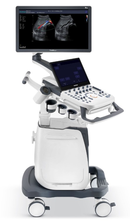 thiết kế máy siêu âm 5d màu sonoscape p25 pro hiện đại, màn hình lớn 23.8 inch, 5 cổng cắm, chất lượng hình ảnh độ phân giải cao
