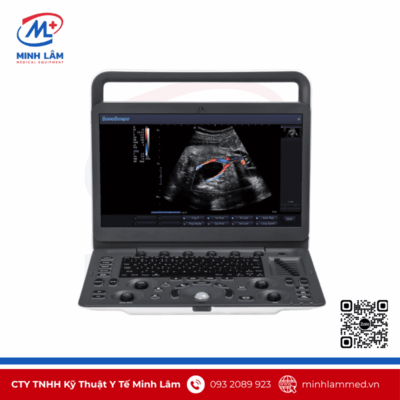 Máy siêu âm xách tay Sonoscape E2pro chính hãng, tiêu chuẩn FDA Mỹ