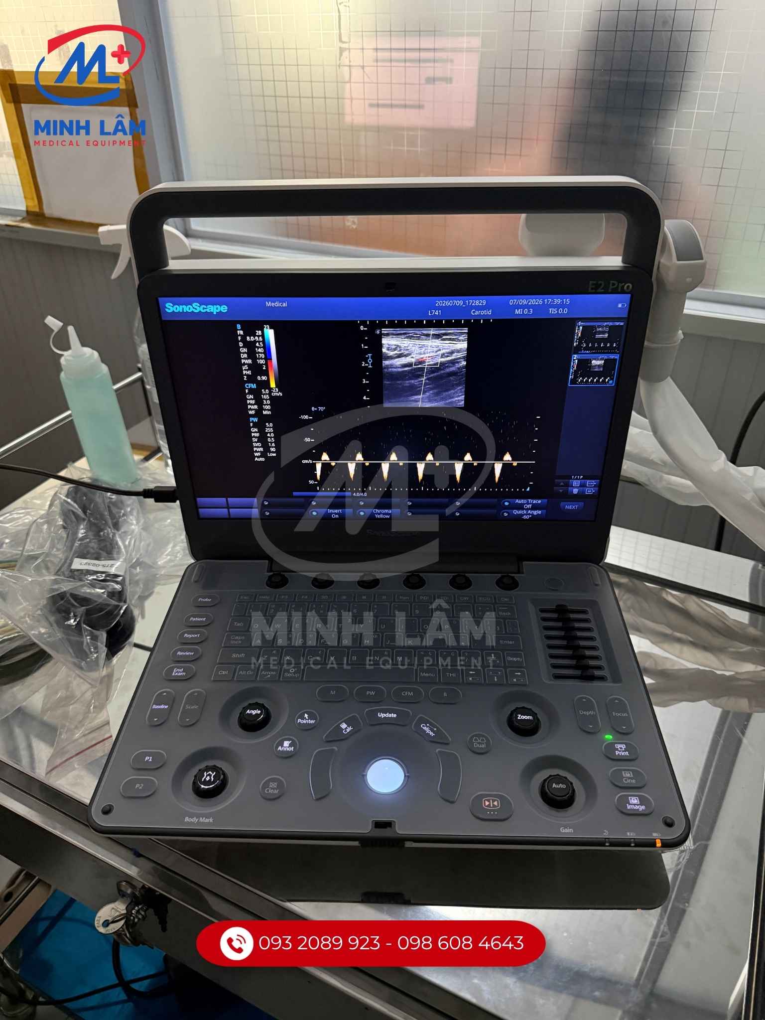 Sonoscape E2Pro được sử dụng tại phòng khám.
